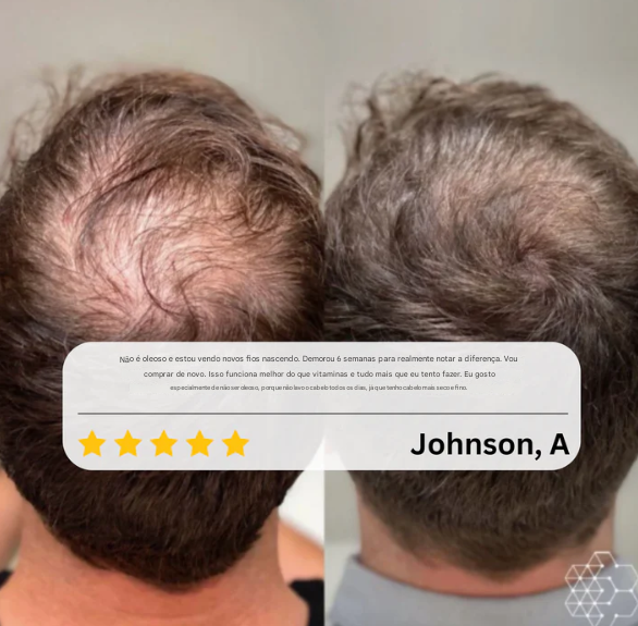 Sumlife Sistema de aplicação HairRevive™ Roll-on