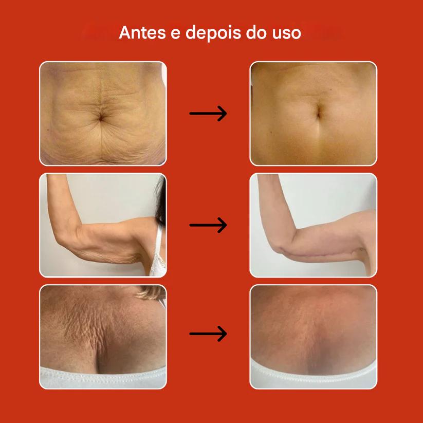 Óleo Mágico Anticelulite 100 ml