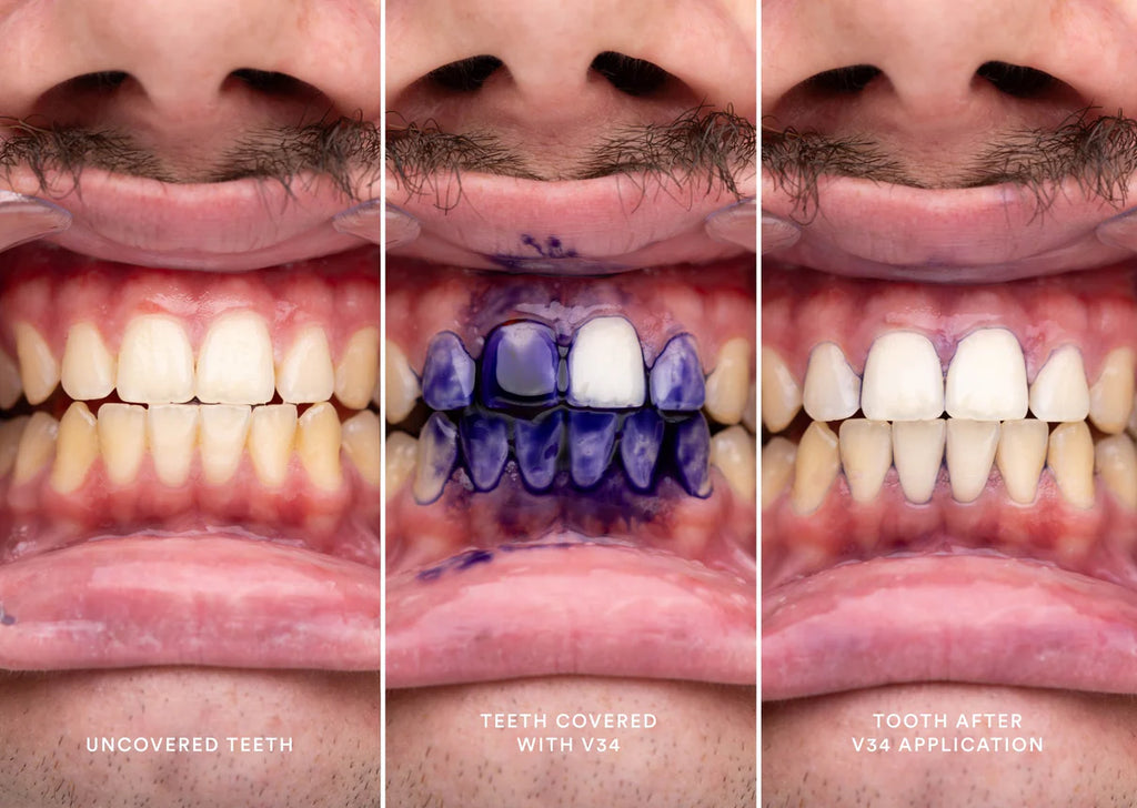 Essência Clareadora Dental V34