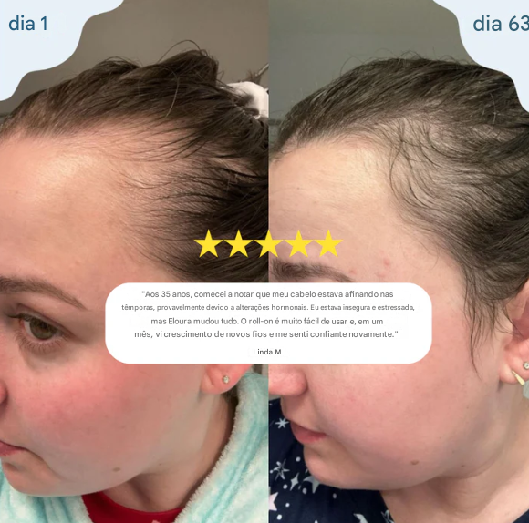 Sumlife Sistema de aplicação HairRevive™ Roll-on